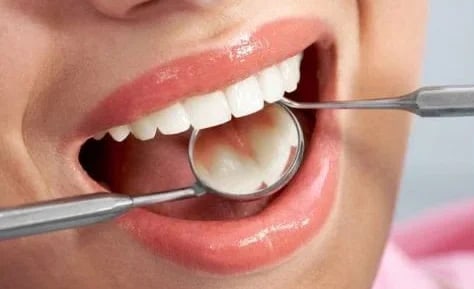 Стоматолог жазган жайкы адаттар эмалга зыян келтирет: эмне кылбоо керек