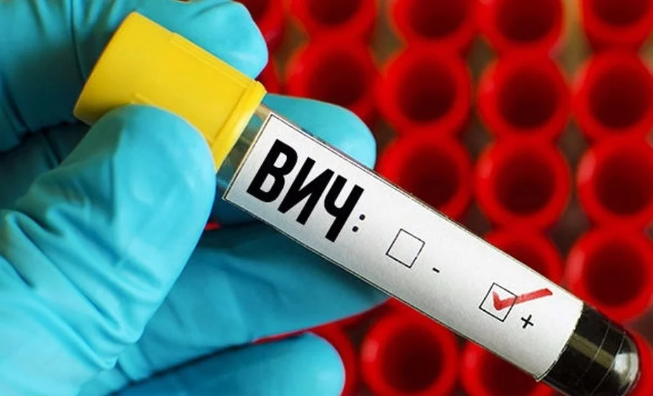 В Кыргызстане провели национальное исследование: выявлены уровни распространенности вирусных гепатитов В, С и D