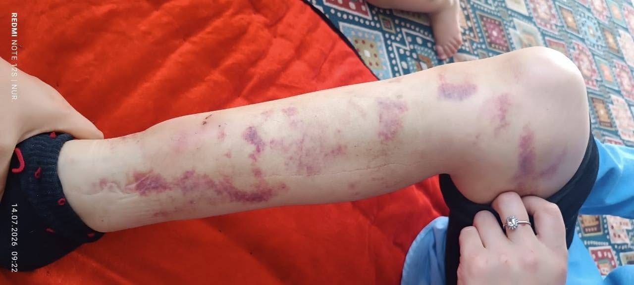 В соцсетях рассказали о многолетнем домашнем насилии над жительницей Дача-Суу; родственники обратились в МВД